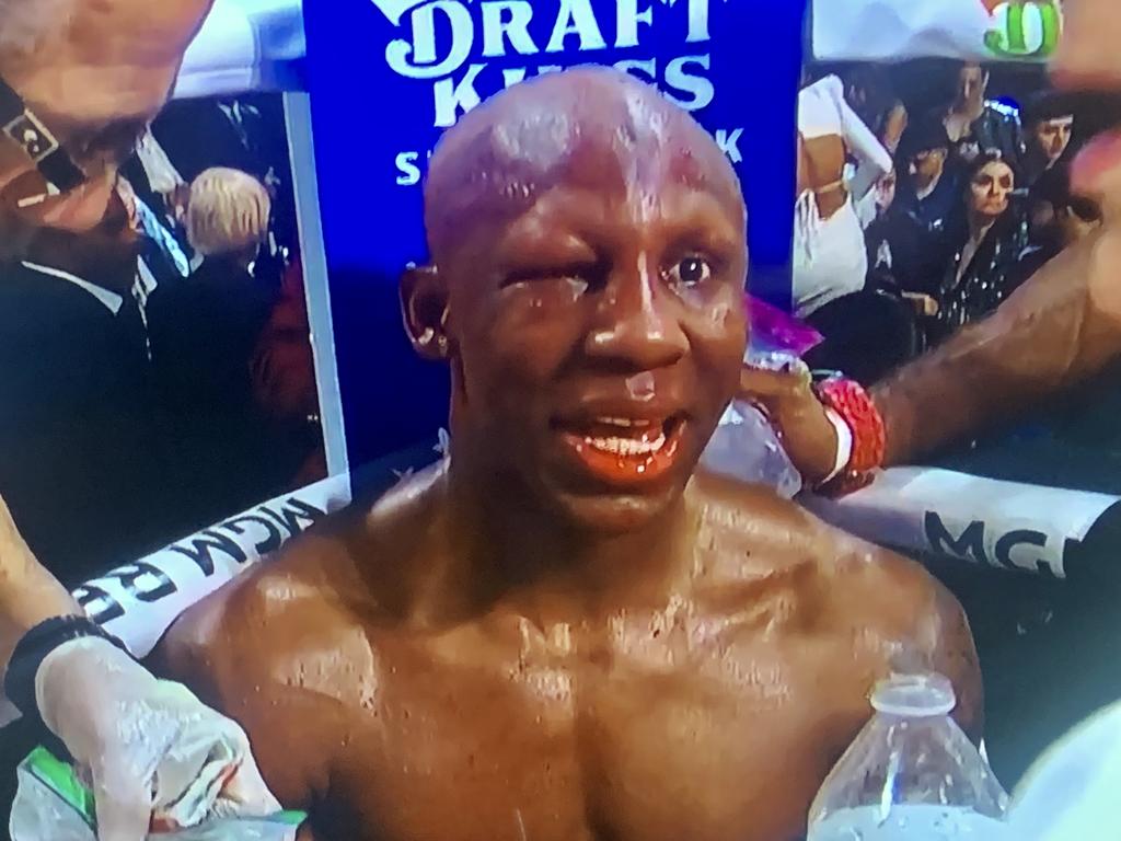 Yordenis Ugas shows the damage he’s taken sitting in his corner against Mario Barrios. Photo: Fox Sports