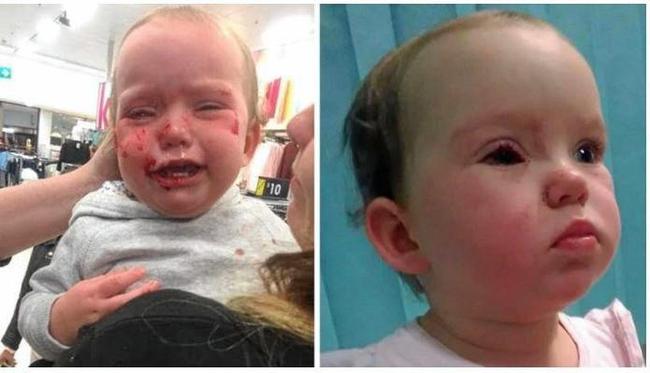 DISTRESSING: Hayley Skye Smith&#39;s daughter Amaia injured her eye on the metal prong of a clothes rack at a local Kmart store. Picture: Supplied