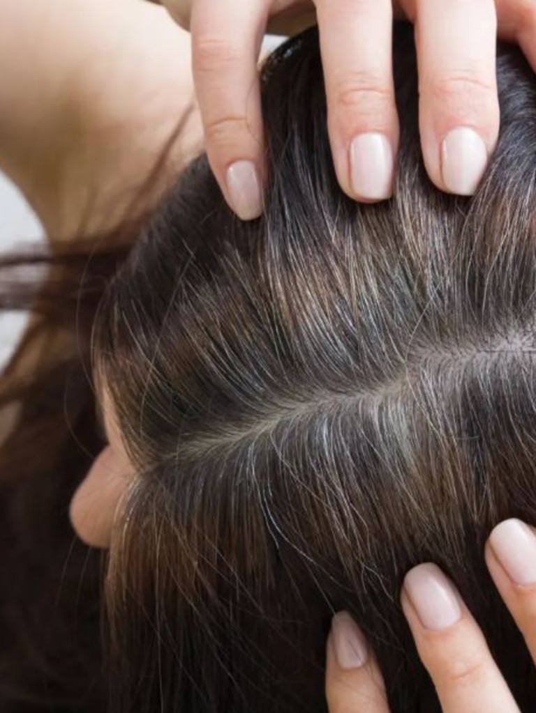 The exact cause of premature greying is still unclear. Picture: NY Post