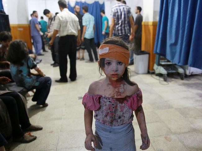 A Syrian girl in a makeshift hospital in Douma, is one of 20 people wounded after a Syrian government attack. Picture: AFP/ABD DOUMANY