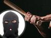 Man beaten with bat in alleged drug deal gone wrong