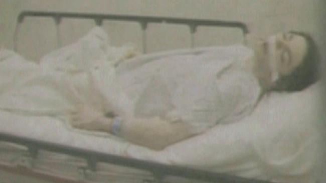 A prosecution exhibit photo projected on the screen in the Conrad Murray involuntary manslaughter trial shows the body of Michael Jackson lying on a gurney.