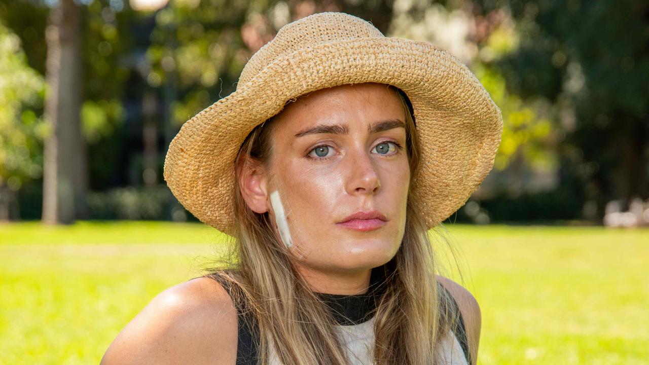 Barrister Imogen Hogan’s beauty spot becomes a melanoma | The Advertiser