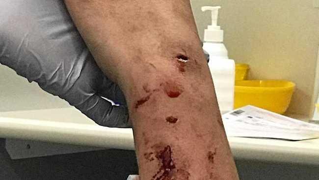 Two people suffered puncture wounds from a dog attack in South Grafton on Thursday, 31st May, 2018. Picture: Contributed