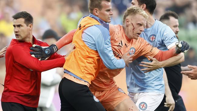 *APAC Sports Pictures of the Week - 2022, December 19* - MELBOURNE, AUSTRALIA - DECEMBER 17: A bleeding Tom Glover of Melbourne City is escorted from the pitch by team mates after fans stormed the pitch during the round eight A-League Men's match between Melbourne City and Melbourne Victory at AAMI Park, on December 17, 2022, in Melbourne, Australia. (Photo by Darrian Traynor/Getty Images)