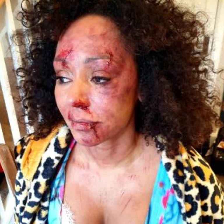 Mel appears beaten, bloody and bruised in the shocking domestic violence video. Picture: Women's Aid