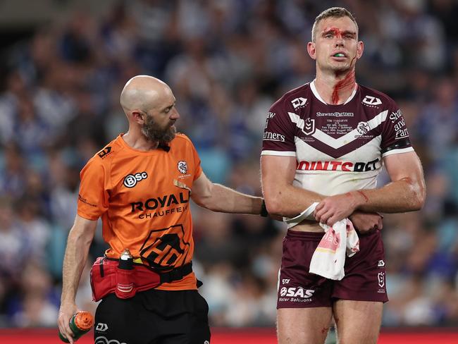 SYDNEY, AUSTRALIA - AUGUST 30:  Tom Trbojevic of the Sea Eagles is assisted by a trainer after an injury and a head cut during the round 26 NRL match between Canterbury Bulldogs and Manly Sea Eagles at Accor Stadium on August 30, 2024, in Sydney, Australia. (Photo by Cameron Spencer/Getty Images)