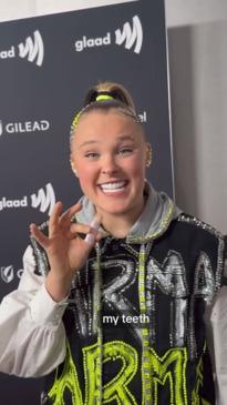 JoJo Siwa reveals she spent $75,000 on cosmetic surgery