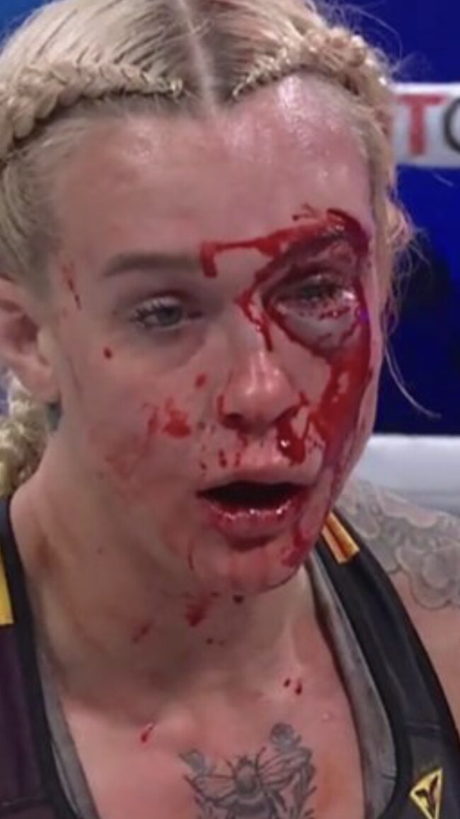 Taylor Starling after a brutal bare-knuckle fight with Charisa Sigala.