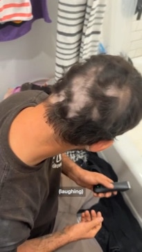 Daughter accidentally shaves her dad's head