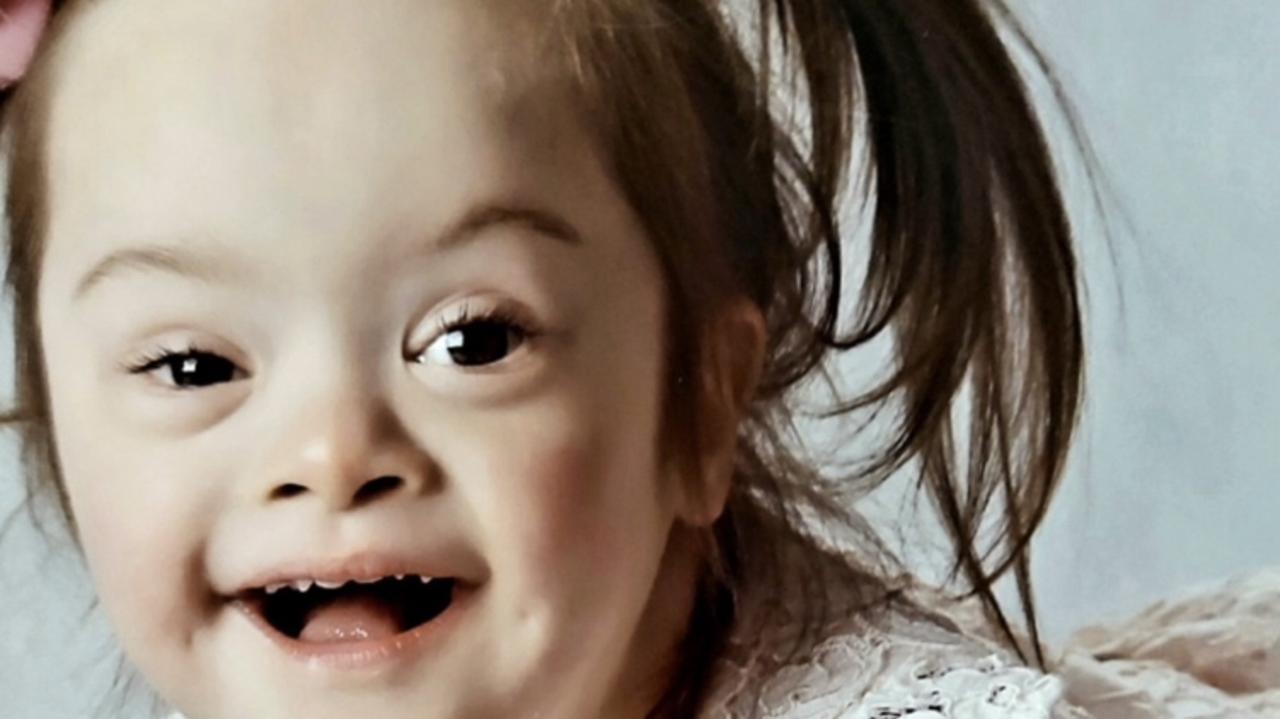 Coronial inquest to examine death of a toddler with down syndrome ...