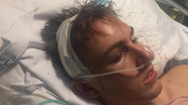 Liam Mahoney, 23, was violently assaulted on a night out in Melbourne.