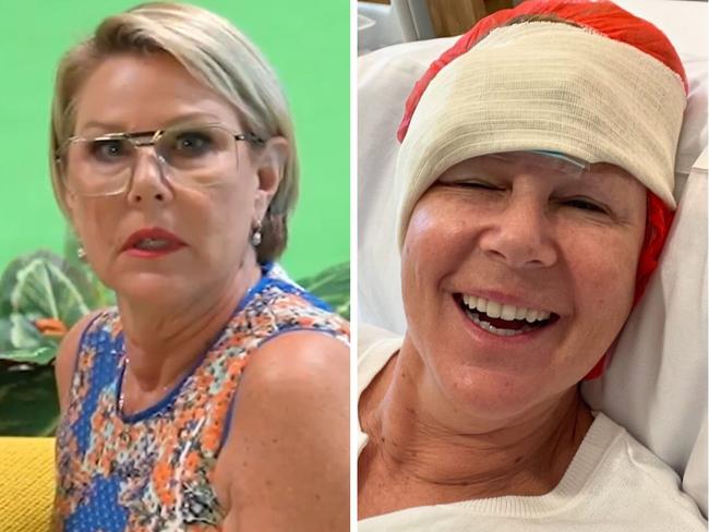 Julia Morris has revealed her recent skin cancer scare.