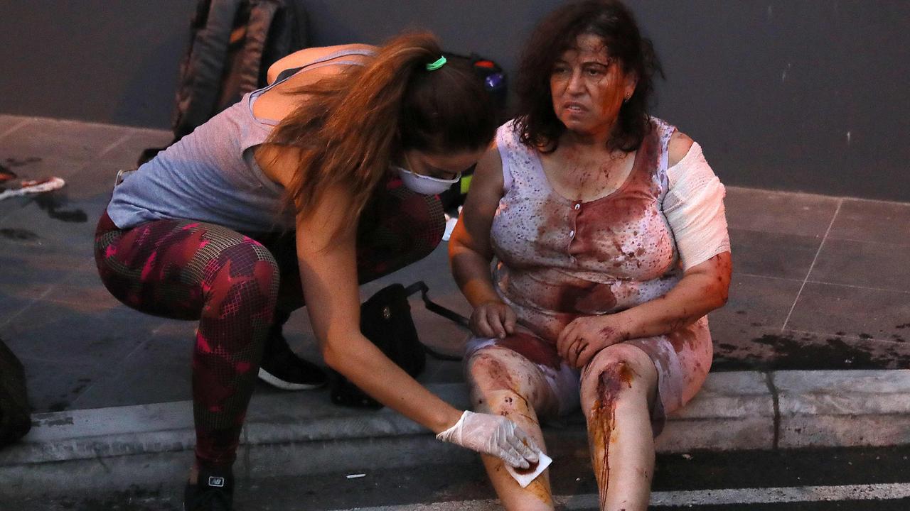 Wounded people are waiting outside Beirut’s overwhelmed hospitals. Picture: Ibrahim Amro/AFP