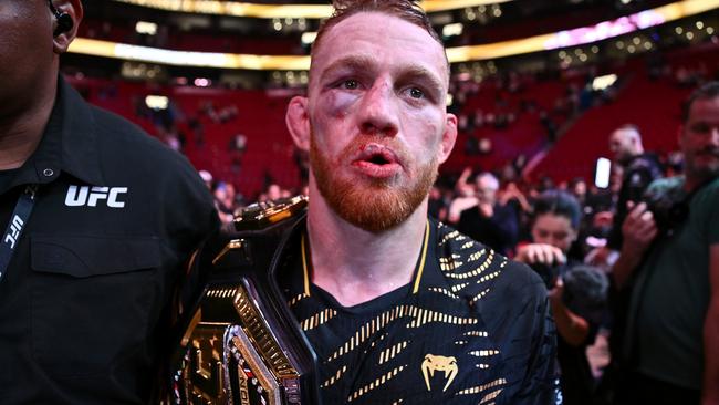 JDM had a nasty shiner but left with the belt. (Photo by Minas Panagiotakis/Getty Images)