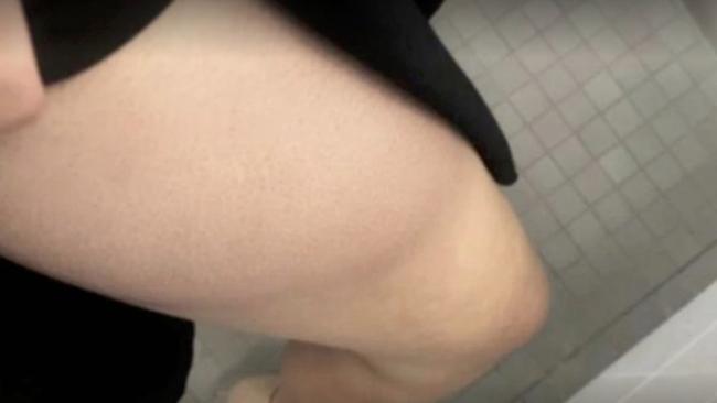 Brittany Higgins took a photo of a bruise on her leg she originally claimed was sustained during an alleged rape. Picture: Seven News Spotlight