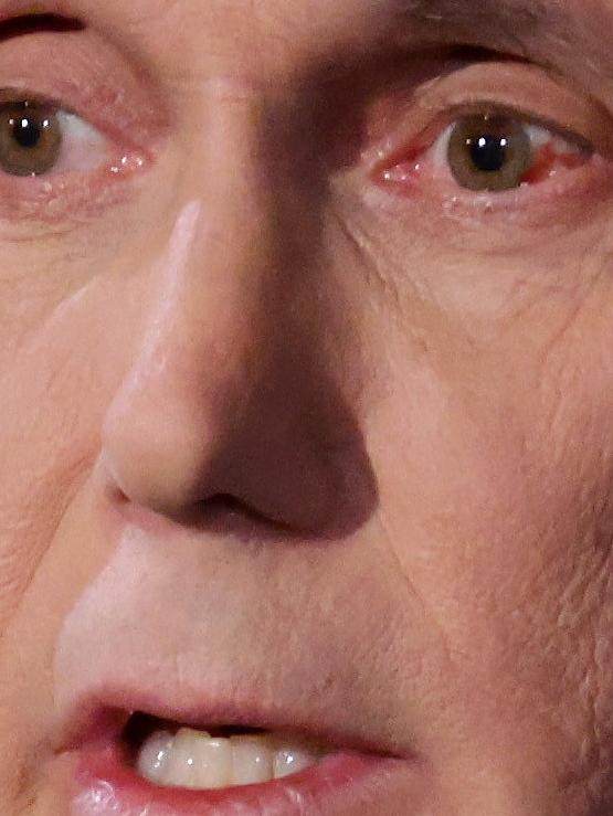 Mike Pence’s reddened eye sparked the theory he might have coronavirus. Picture: Alex Wong/Getty Images/AFP