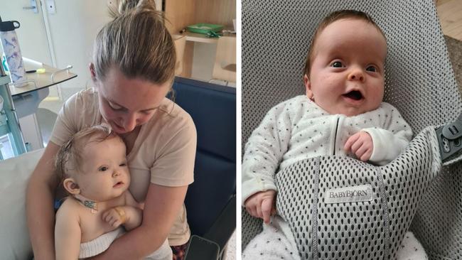 Isla's parents knew something was wrong when her head shape began to grow. Images: Supplied