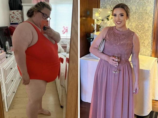 A woman who ate 10 chocolate bars a day shed 120 kilograms thanks to surgery and would “do it again” - despite losing her gallbladder. Picture: SWNS
