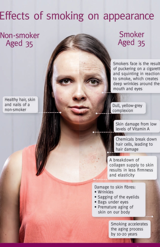 Queensland Health’s infographic, detailing exactly how you age if you’re a smoker.