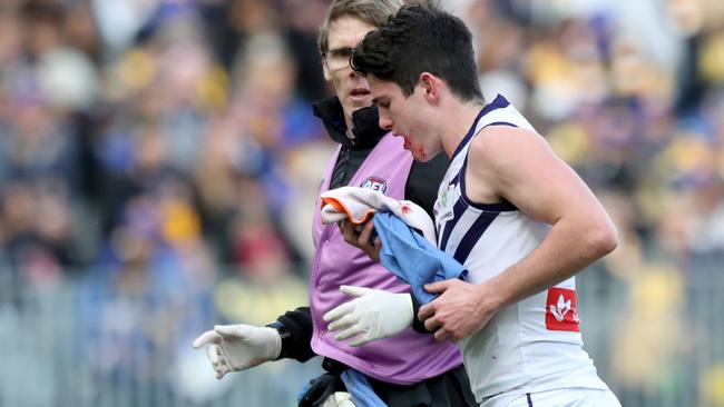 Andrew Brayshaw has suffered a fractured jaw as a result of the incident.