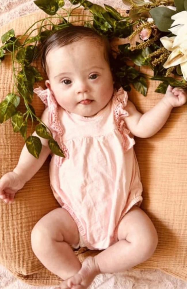 Thea Hall: Born on 27/12/2022 and soon to be one year old, Thea is her mum, Amy Aked's happy &amp; cuddly baby with Down syndrome who bring lots of joy to life.