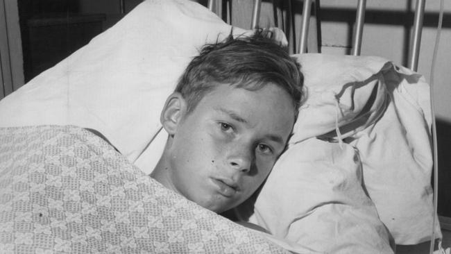 Raymond Short in hospital after being attacked by a  shark at Coledale beach in 1966 when he was 13. .