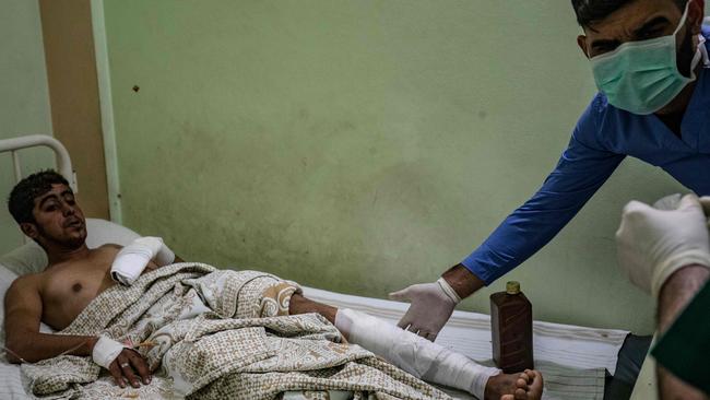 A wounded man receives treatment at a hospital in the northeastern Syrian Kurdish city of Qamishli following a Turkish air strike on a convoy of civilians and journalists. Picture: AFP.