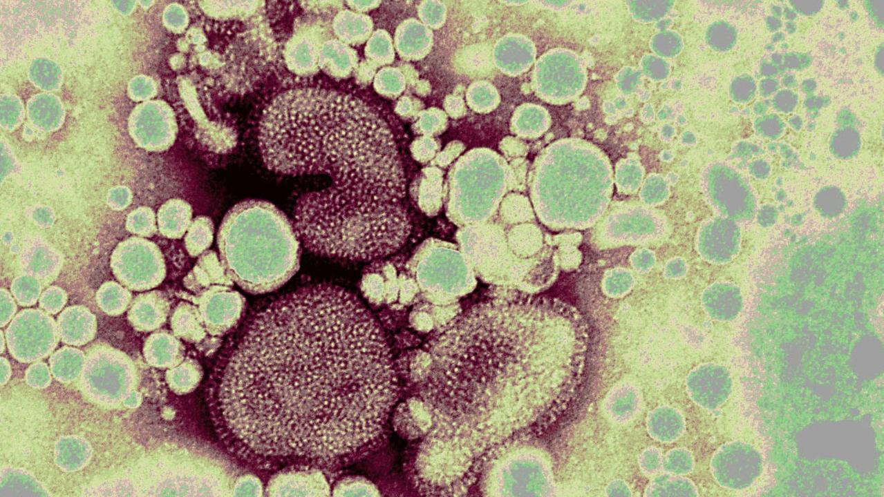 H5N1 Virus: Bird Flu Spreads Across The Globe, Threatening Food Supply ...