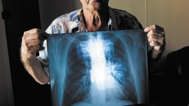 BLACK LUNG: Percy Verrall (pictured) was diagnosed with black lung disease in 2015. He was the first Australian diagnosed with the disease in 30 years. Andrew Lockhart is now suing for $2.2m after he was diagnosed in 2018.