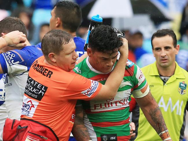 Issac Luke leaves the game after being kicked in the head against the Bulldogs.