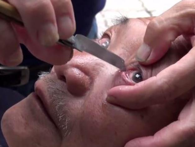 The Chinese art of 'eyeball shaving' is supposed to have health benefits. It would want to, because that is truly messed up.