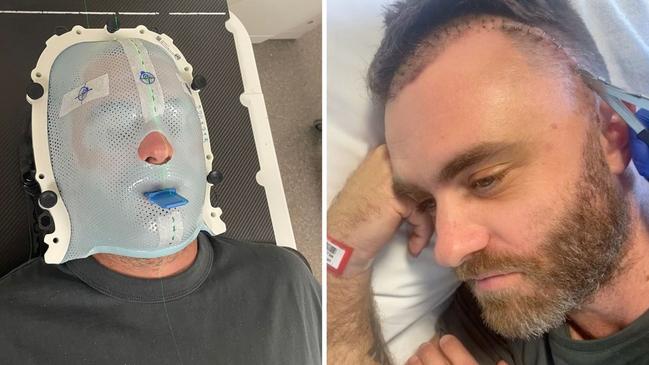 Wade Williams during his health battle with a brain tumour.