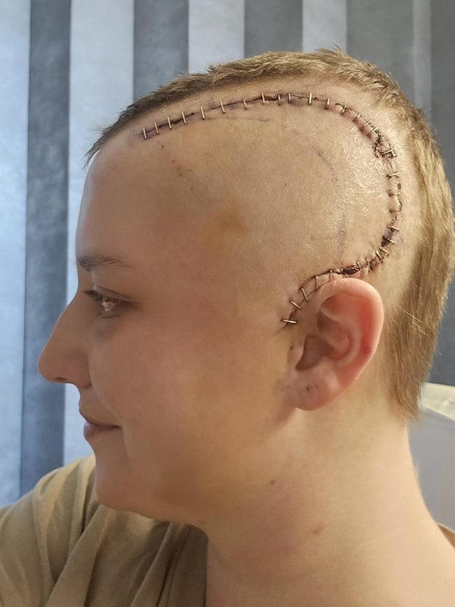 Saffron Fry, 27, was diagnosed with brain cancer in May this year after she began suffering seizures and hearing voices. Picture: Supplied