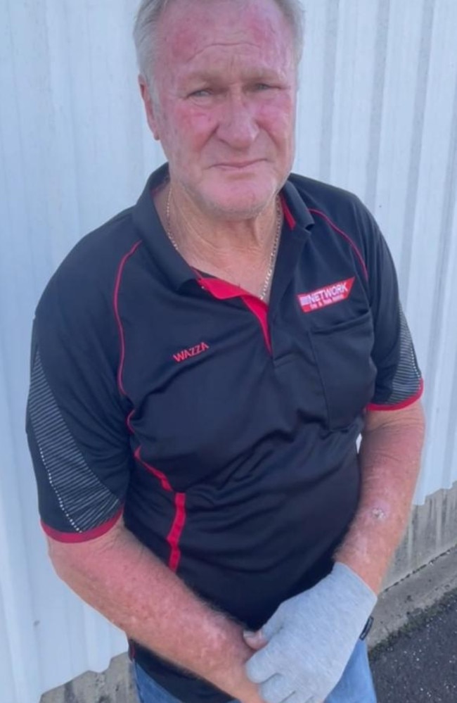 Warren West, owner of Bundaberg's Network Car and Truck Rentals, sustained a hand injury when thieves attacked him with a knife when he busted them stealing trucks from his business.