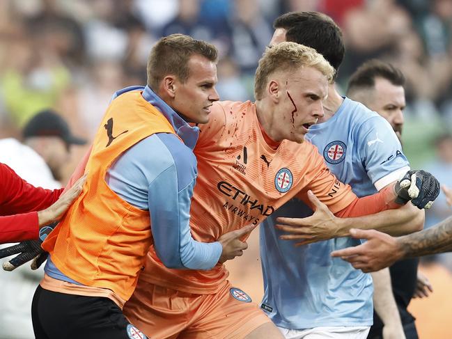 The ugly scenes following the pitch invasion. (Photo by Darrian Traynor/Getty Images)