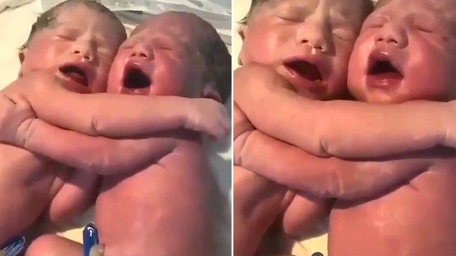 The incredible moment a pair of newborn twins hug and console each other just moments after birth has been caught on camera.