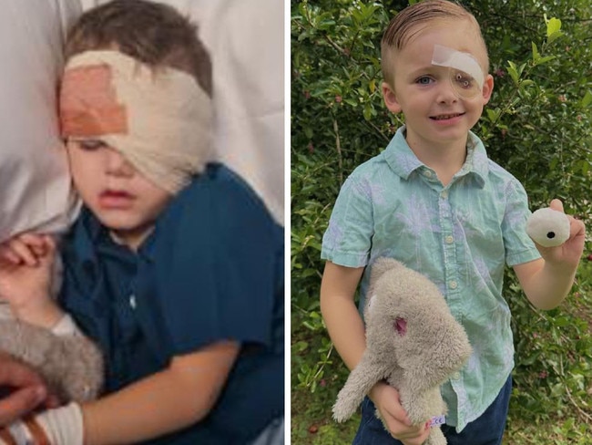 Mum’s plea after son’s eye removed