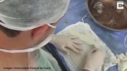 Doctors create vagina out of fish skin