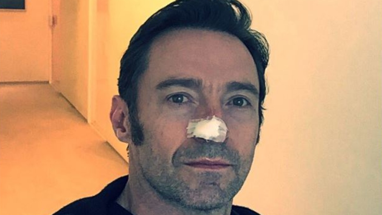 Hugh Jackman has been vocal about the importance of sunscreen after his latest skin cancer treatment. Picture: @RealHughJackman