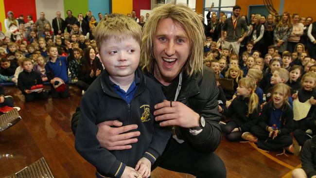 Essendon captain Dyson Heppell shaved off his beard for Warranwood Primary School student Harrison Pennicott. Picture: MICHAEL KLEIN.