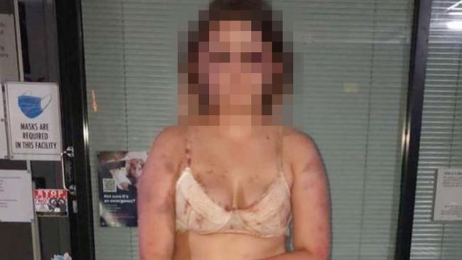 The victim’s injuries left her unrecognisable. Picture: Instagram