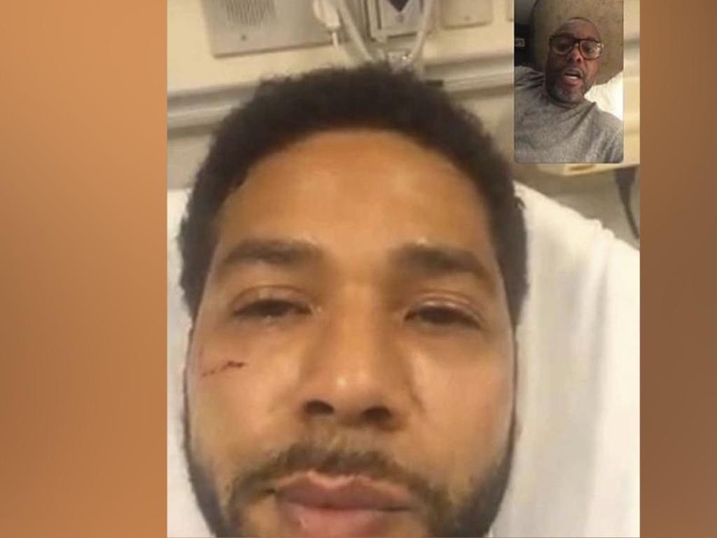 Director and Empire creator Lee Daniels shares a screengrab showing Jussie Smollett’s injuries from an alleged bias crime attack in Chicago on January 28, 2019. Picture: Lee Daniels