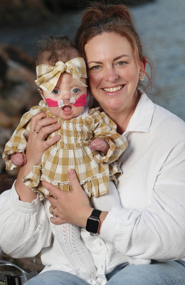 Daisy Stevens, seven months, who has a rare and random genetic mutation known as Apert Syndrome, with mum Debb. Picture: Mater Hospital