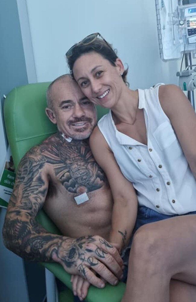 Danny Hawkins, pictured with wife Alicia, sustained burns to the top of his head, arms and hands as he tried to escape the blaze.