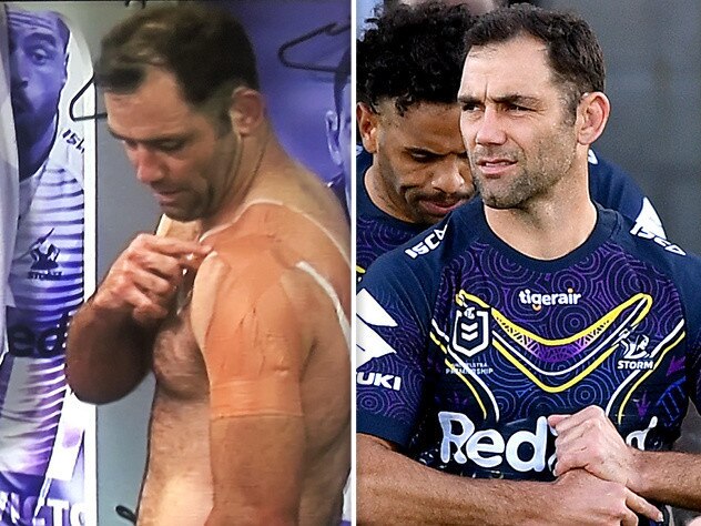 Injured Melbourne Storm captain Cameron Smith.