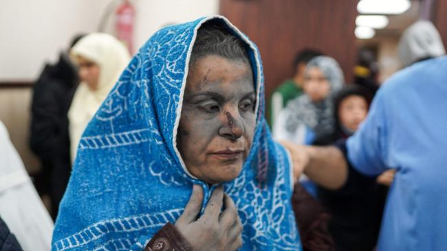 Women and children wounded in Israeli attack on Nuseirat refugee camp. Picture: AFP