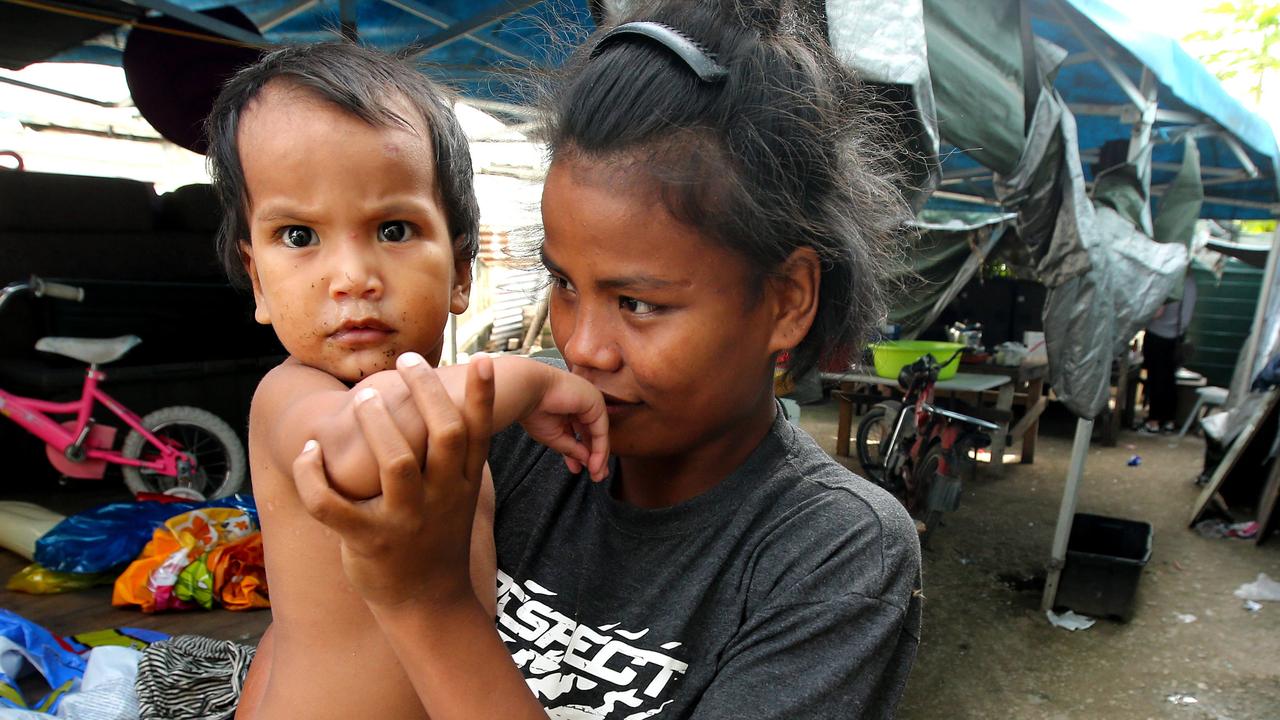 Many of the people of Nauru live in near poverty, with virtually no national economy and a slew of health and social issues. Picture: Nathan Edwards