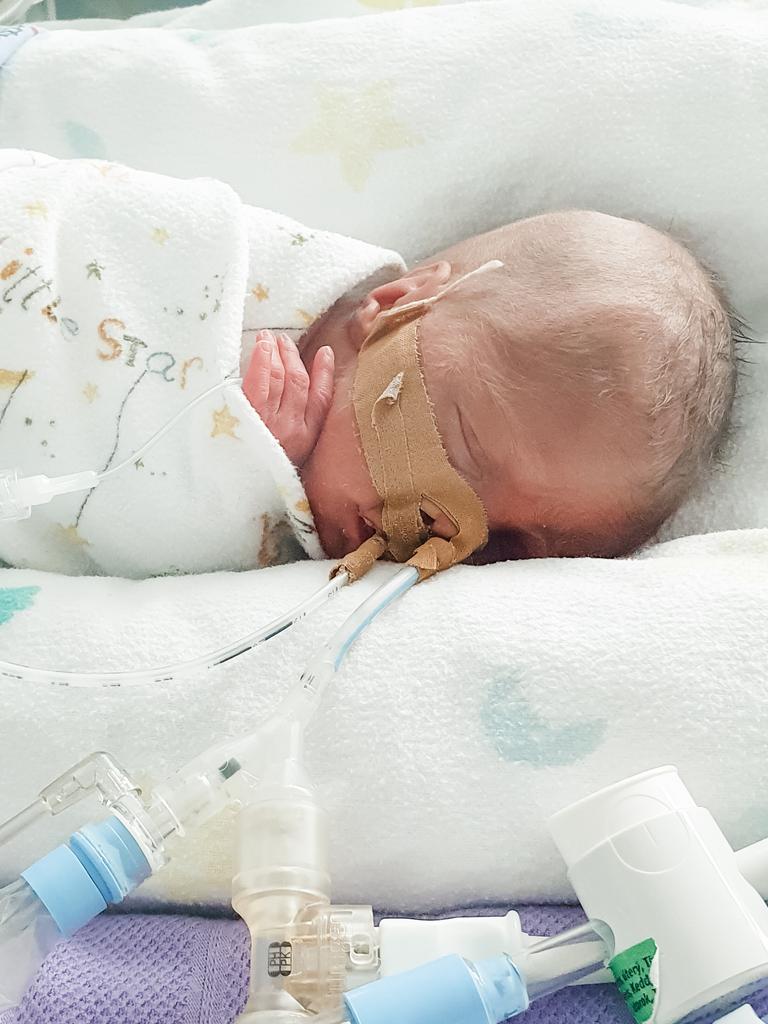 Alexander (850g) was admitted to the neonatal intensive care unit (NICU). Picture: Supplied.