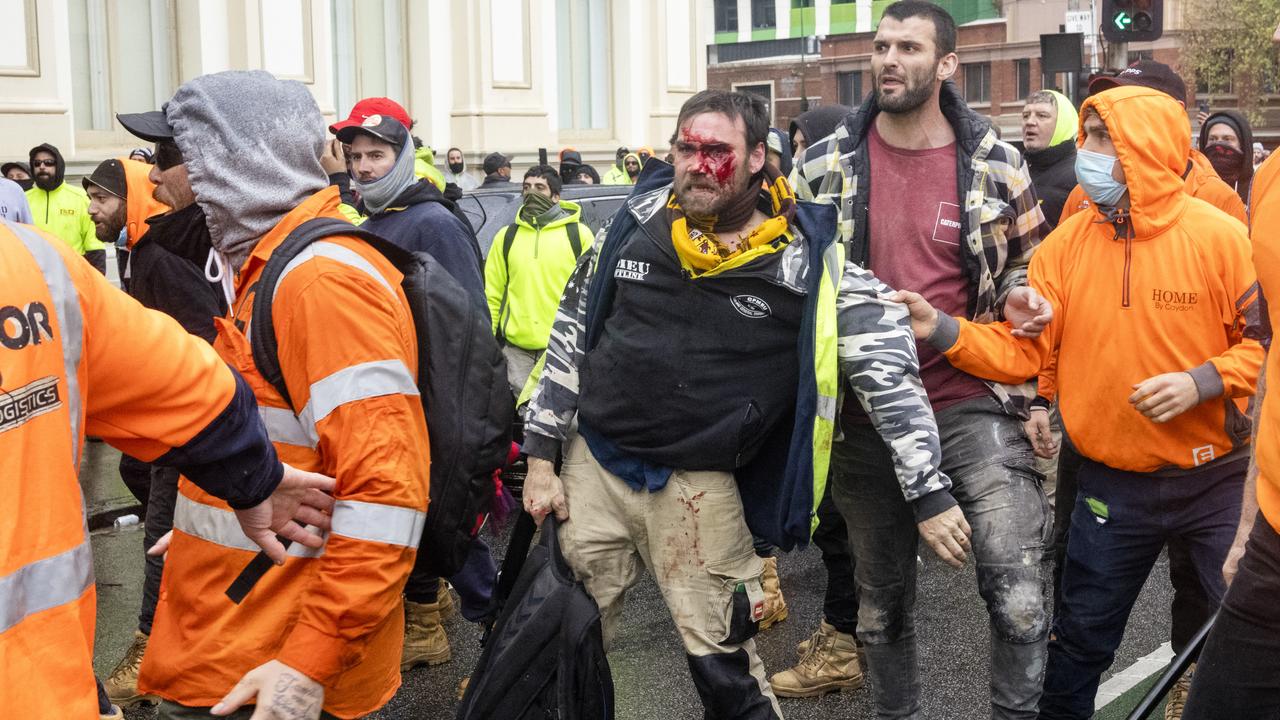 A man with blood on his face at the protest. Picture: NCA NewsWire / David Geraghty